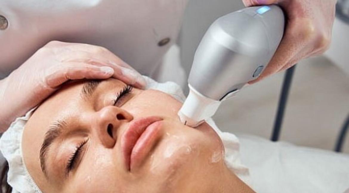 Tratamiento Facial - Radiofrecuencia