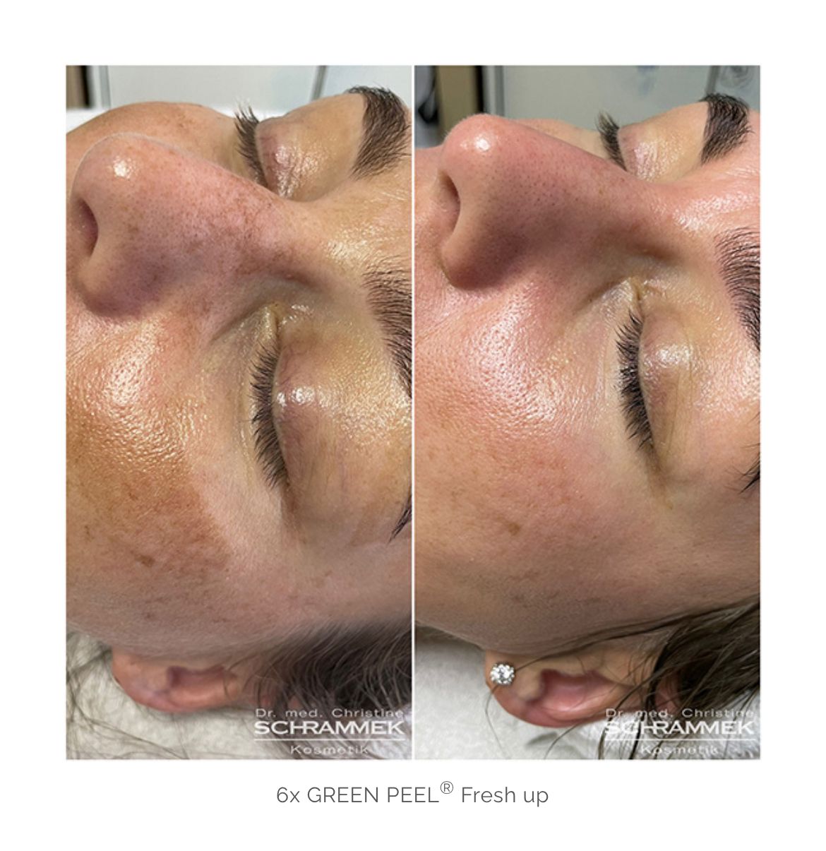 Herbal Peeling classic